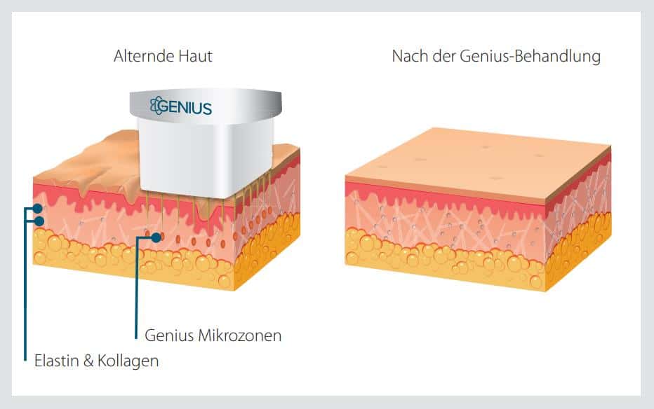 Anti-Aging-Hautaufbau