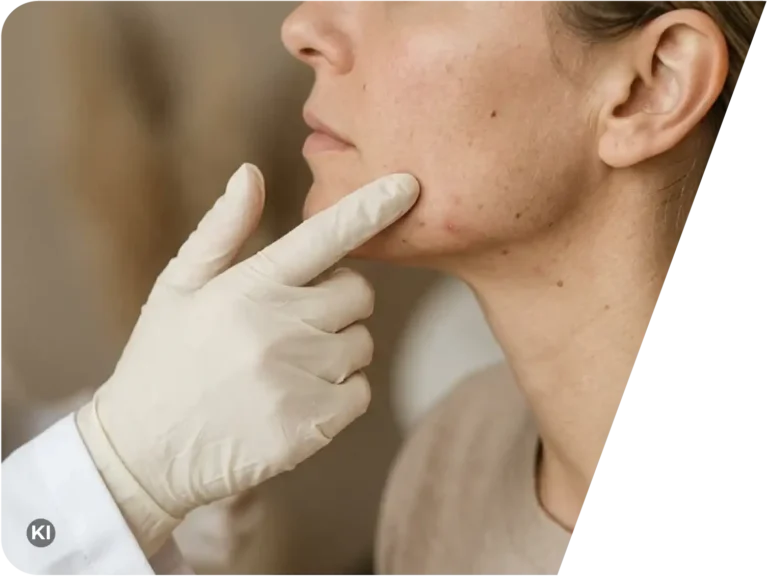 Hand mit medizinischem Handschuh berührt das Kinn einer Frau mit Akne-ähnlichen Hautunreinheiten in einer Hautarztpraxis