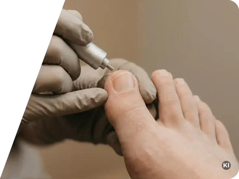 Nahaufnahme einer medizinischen Behandlung an einem großen Zeh mit einem kleinen Handgerät und Handschuhen